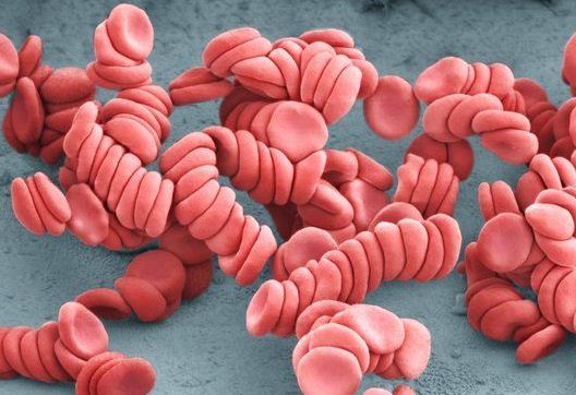 Globules Rouges En Rouleaux Rouleaux – Sonographic Tendencies