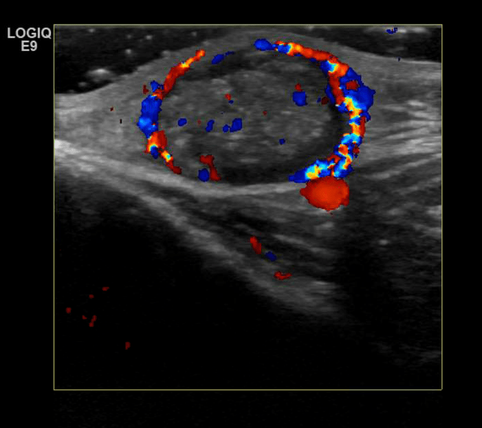 pediatrics-sonographic-tendencies