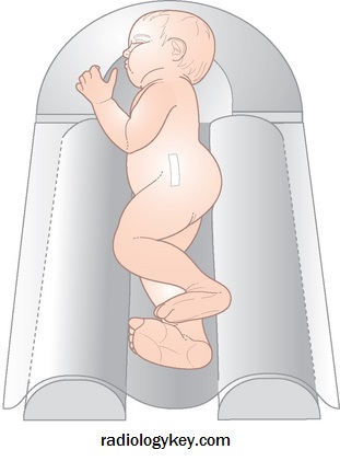 graf-cradle-radiology-key