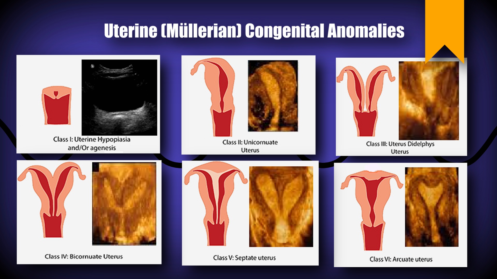 Gynecology – Sonographic Tendencies