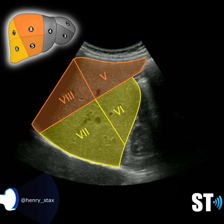 Couinaud’s Liver Segments – Sonographic Tendencies