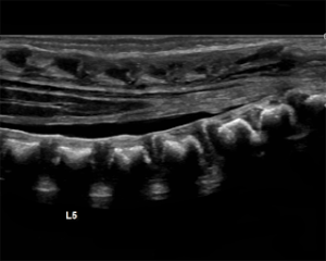 Neonatal/Infant Spine – Sonographic Tendencies
