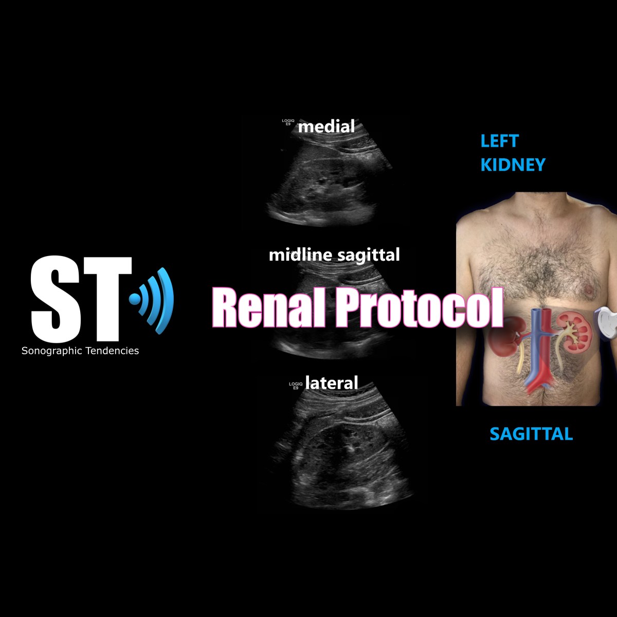 Renal Ultrasound Complete Protocol – Sonographic Tendencies