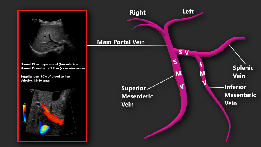 Portal Vein Doppler – Sonographic Tendencies