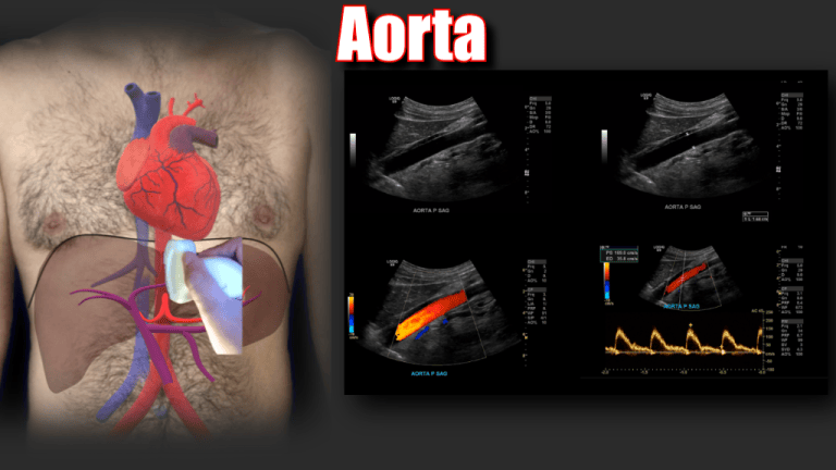 Portal Vein Doppler – Sonographic Tendencies