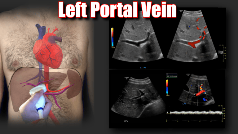 Portal Vein Doppler – Sonographic Tendencies