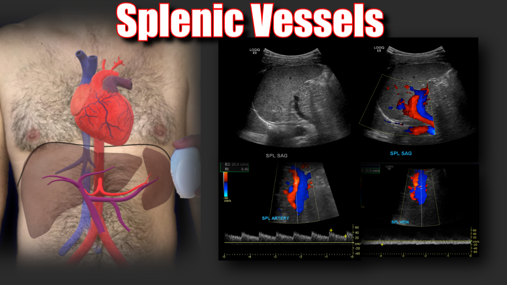 Portal Vein Doppler – Sonographic Tendencies