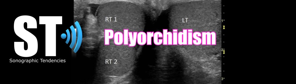 Polyorchidism – Sonographic Tendencies
