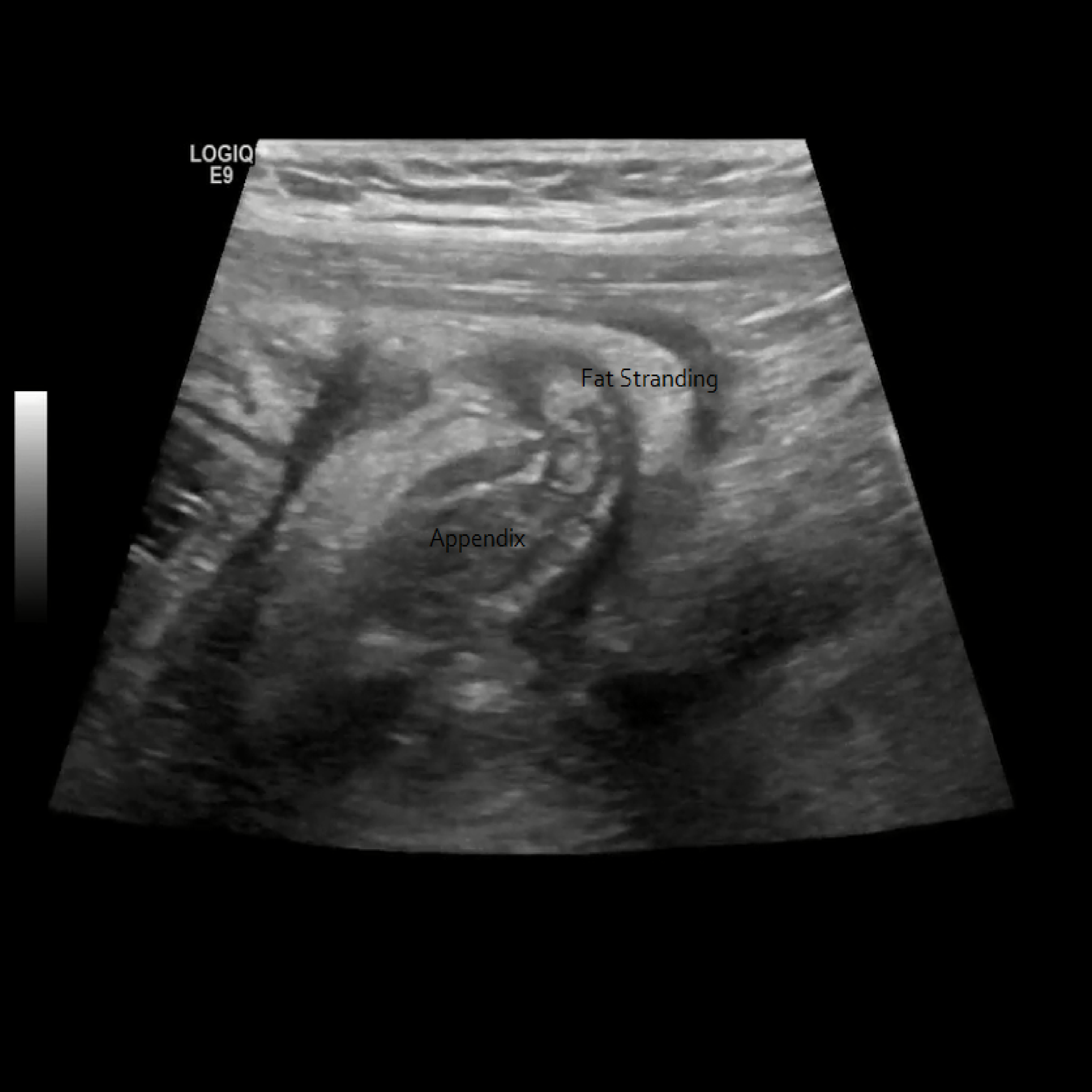 Appendix Gallery – Sonographic Tendencies